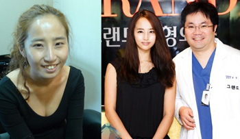 에로배우 최은, 양악수술로 청순미인 변신